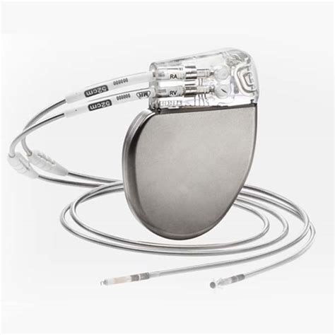 Image result for Pacemaker X-ray Algorithm