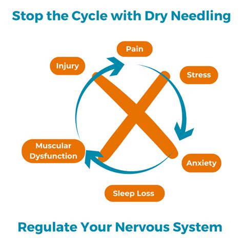 How does dry needling help reduce pain? - Proactive Rehabilitation & Wellness
