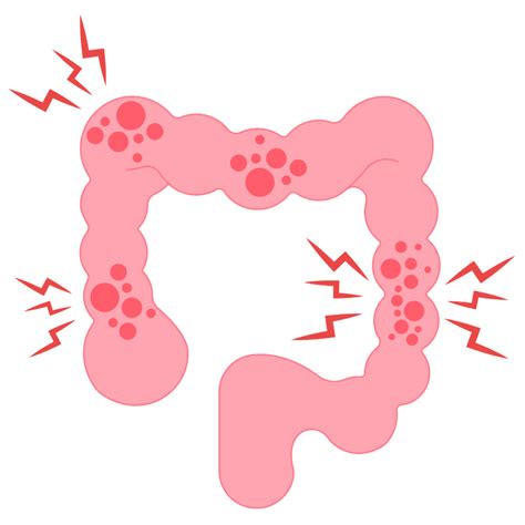 April marks Irritable Bowel Syndrome (IBS) Awareness Month - John T ...