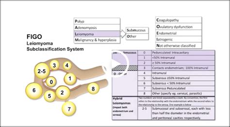 Image result for Depth First Search Image Diagram Example