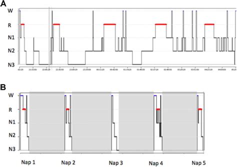 Narcolepsy Sleep Cycle Graph 的图像结果