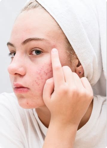 What Are Different Types of Skin and How to Identify Them: A Comprehen ...