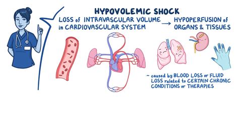 Shock Pathophysiology 的图像结果