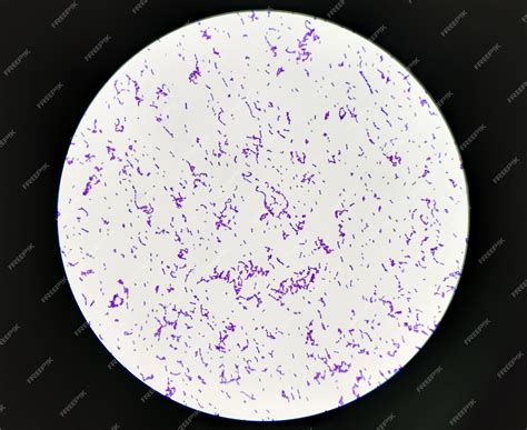 Gram Stain Staphylococcus Aureus