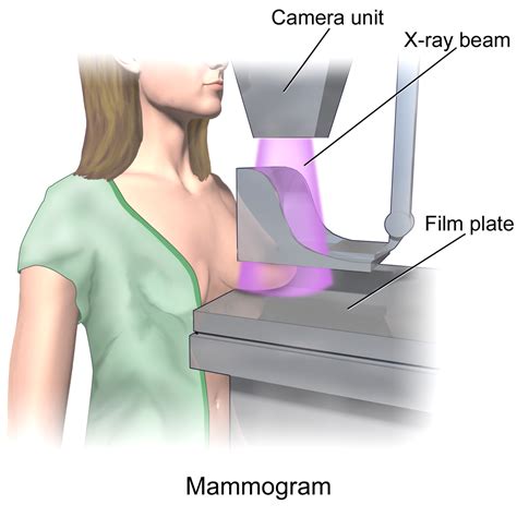 MAMMOGRAPHY EQUIPMENT