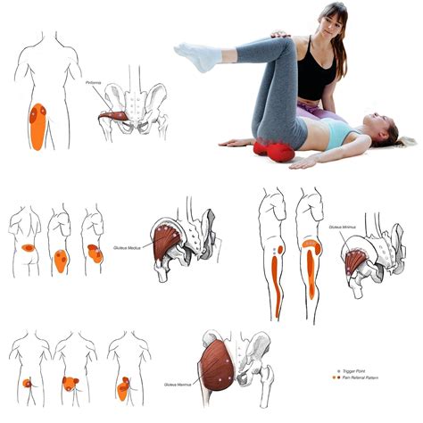 LittleMum Back Trigger Points Massage, Gluteus & Piriformis Myofascial ...