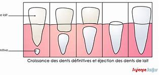 Image result for Une Dent En Or