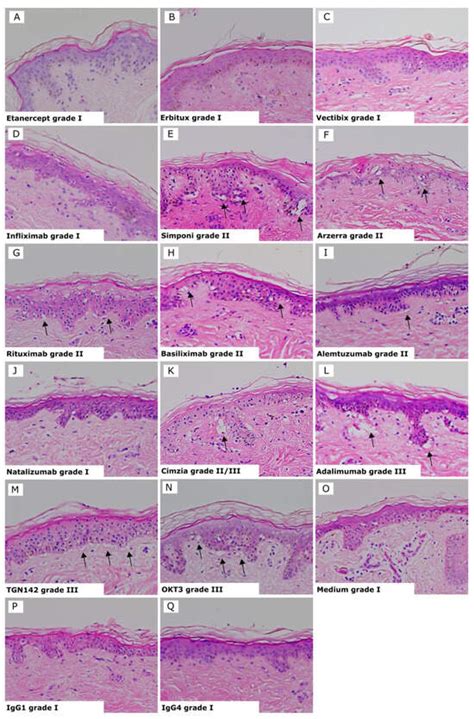Toxics | Special Issue : Skin Sensitization Testing Using New Approach ...