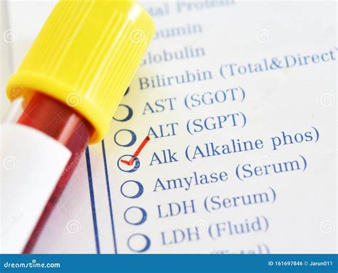 What Is An Alkaline Blood Test at Clyde Salvador blog