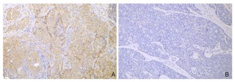 Development of Monoclonal Antibodies Targeting Canine PD-L1 and PD-1 ...