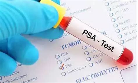 COVID-19 infection raises serum PSA levels in men with benign prostatic ...