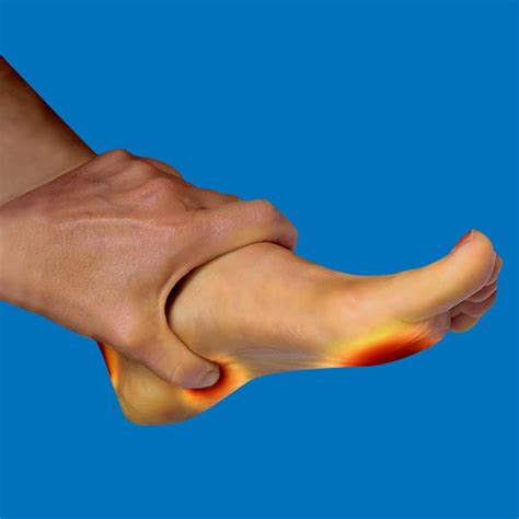 Conditions/Treatments - Relieve Foot Pain & Leg Pain