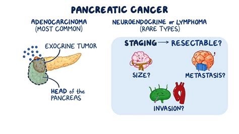 Types Of Pancreatic Cancer What Makes A Pancreatic Cancer Resectable?