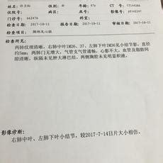 大学生被查出肺结核是怎样的感受？？ - 知乎