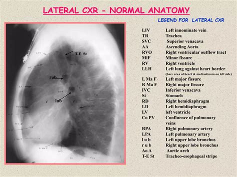 Chest Radiology.ppt