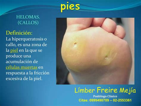 DR. LIMBER FREIRE CONFERENCIA "UÑAS" | Nail diseases and disorders ...