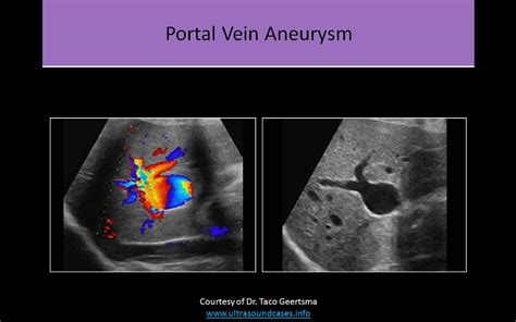 How To Read Ultrasound Of Abdomen at Holly Brough blog