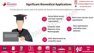 Image result for Biomedical Mini Projects Using MATLAB