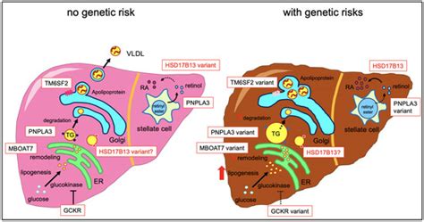 Is HSD17B13 Genetic Variant a Protector for Liver Dysfunction? Future ...