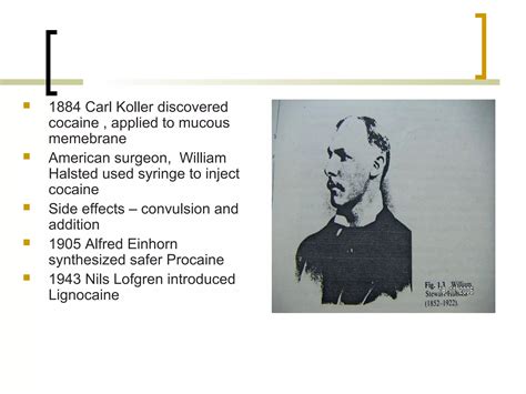 Local Anesthesia Injection Technique 的图像结果