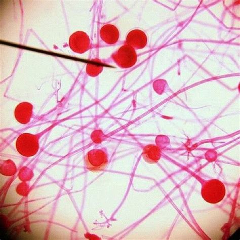 Mold Under Microscope 的图像结果