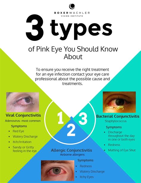 Common Cold Pink Eye at Eva Brown blog