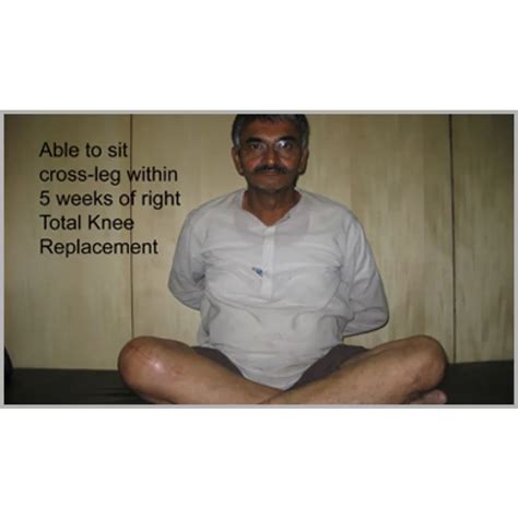 Knee Replacement Surgeon In Juhapura - Dr Samir Nanavati