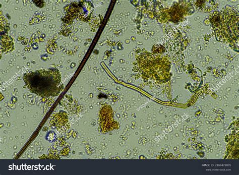 Characteristics Of Fungi Under Microscope at Amelie Challis blog