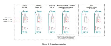 Whitepaper 14: Evaluating the performance of ErbaQik sickle cell rapid ...