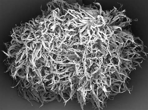 Image result for Electron Microscope Images