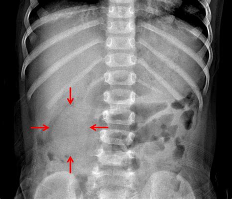 Case #25 - CaseStacks.com