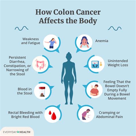 Colon and Rectal Cancer: Your Guide to Symptoms, Treatment, Prevention, and More