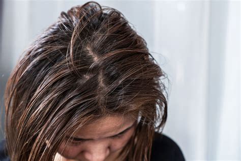 Common Reasons Why Your Hair Is Greasy (and How to Fix It)
