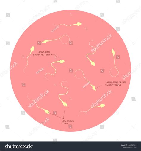 103 Low Semen Images, Stock Photos & Vectors | Shutterstock