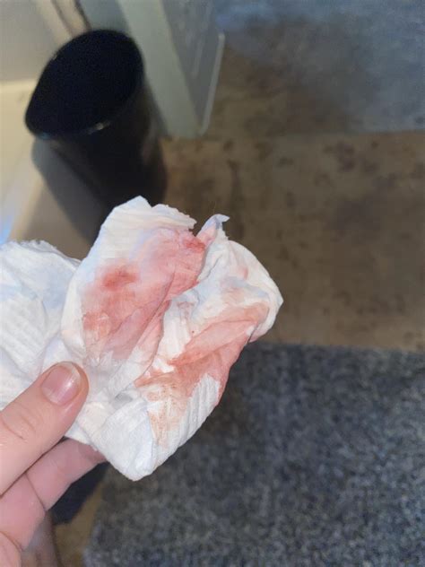 Implantation Bleeding Or Menstrual Cycle