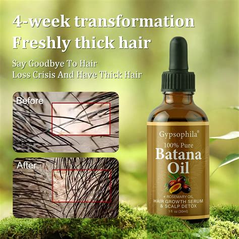 Gypsophila Batana Oil for Hair Growth -100% Pure Natural Hair India | Ubuy