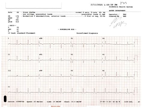 Borderline ECG meaning