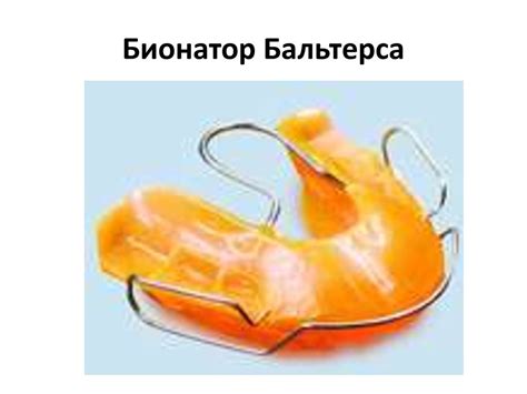 Image result for Fonction JavaScript