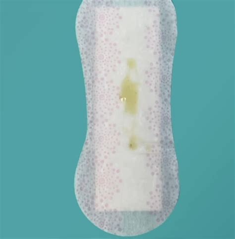 Compare Vaginal Discharge color to identify STD - STD Testing Near Me