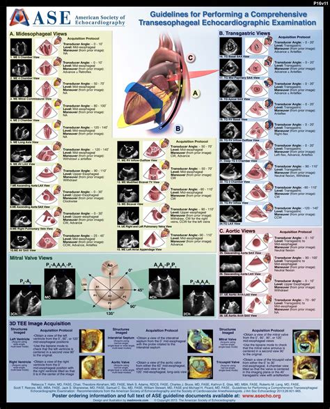 Performing a Comprehensive TEE Poster