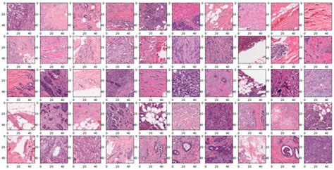 Revolutionizing Breast Cancer Diagnosis: A Concatenated Precision ...