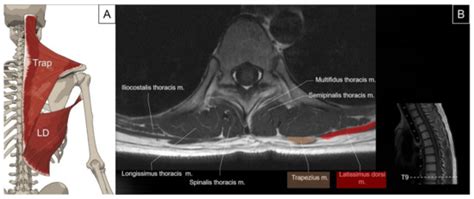 Pictorial Essay on Ultrasound and Magnetic Resonance Imaging of ...