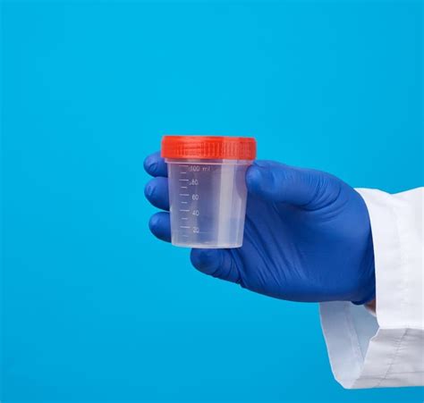 Faecal Calprotectin Normal Range & Interpretation | ExaHealth