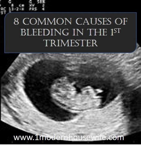 8 Common Causes for Bleeding in the First Trimester - WeHaveKids