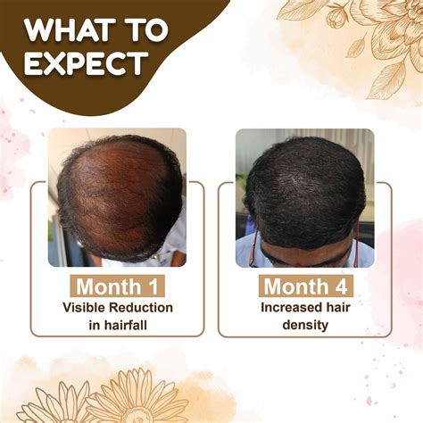 Unisex Hair Products in India – Nonucare