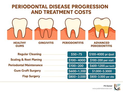 Gum Disease Got You Down? Here's the Real Deal on Treatment Costs - PS Dental Services