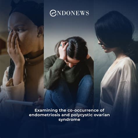 The overlap of endometriosis and polycystic ovarian syndrome | EndoNews