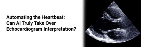 Automating the Heartbeat: Can AI Truly Take Over Echocardiogram ...