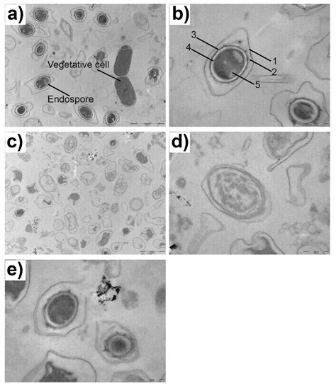 Endospores Under Microscope