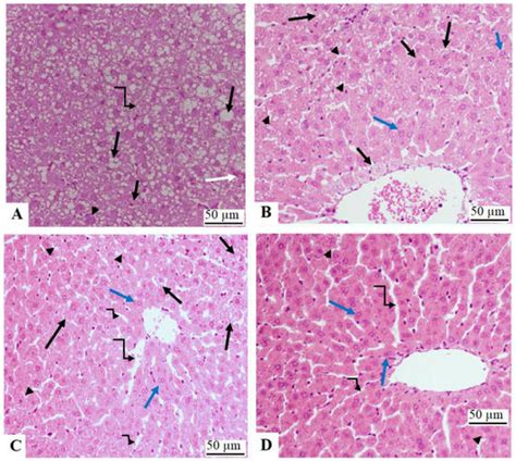 The Synergistic Protective Effect of γ-Oryzanol (OZ) and N ...